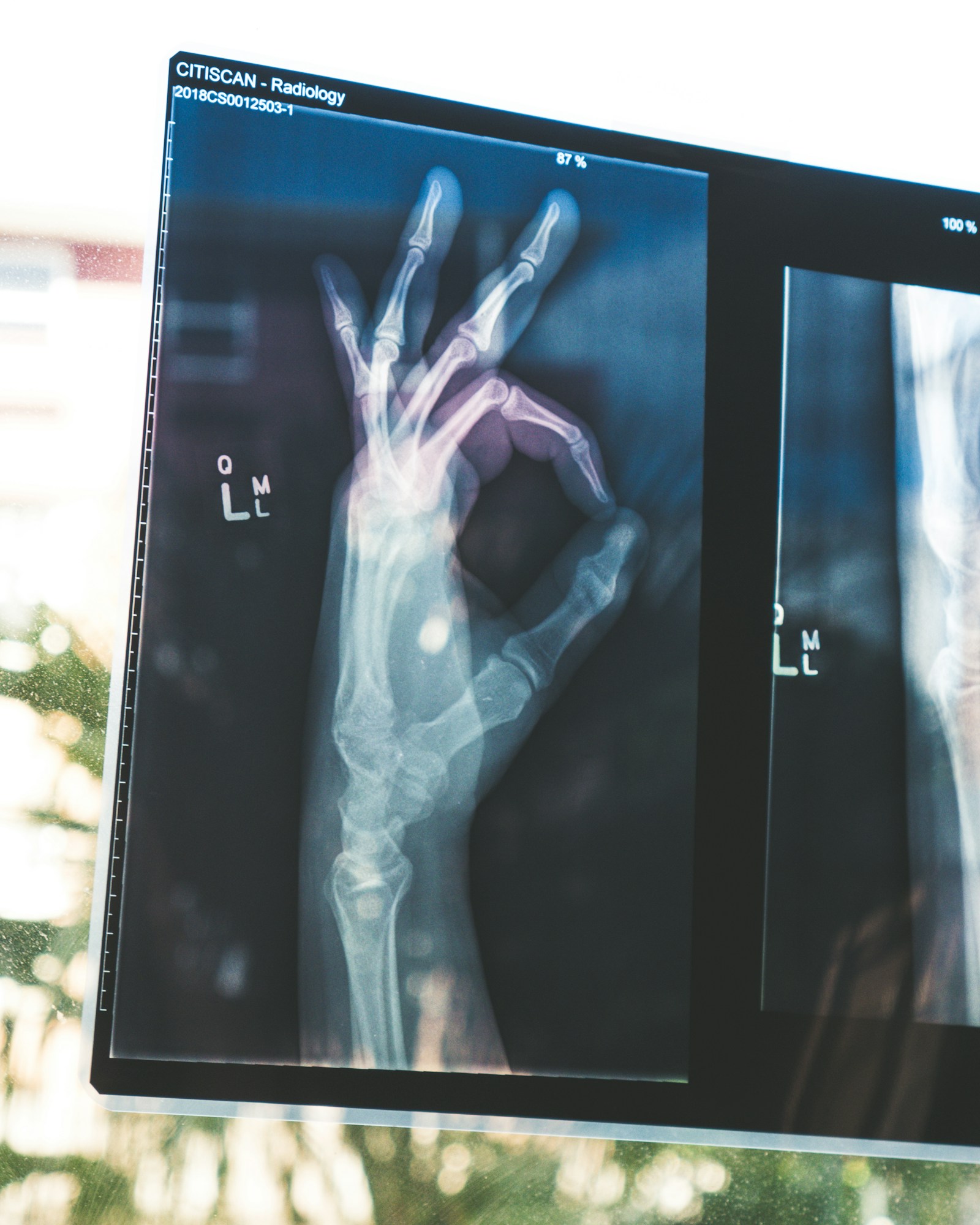 Clinical Scan AI Diagnostics